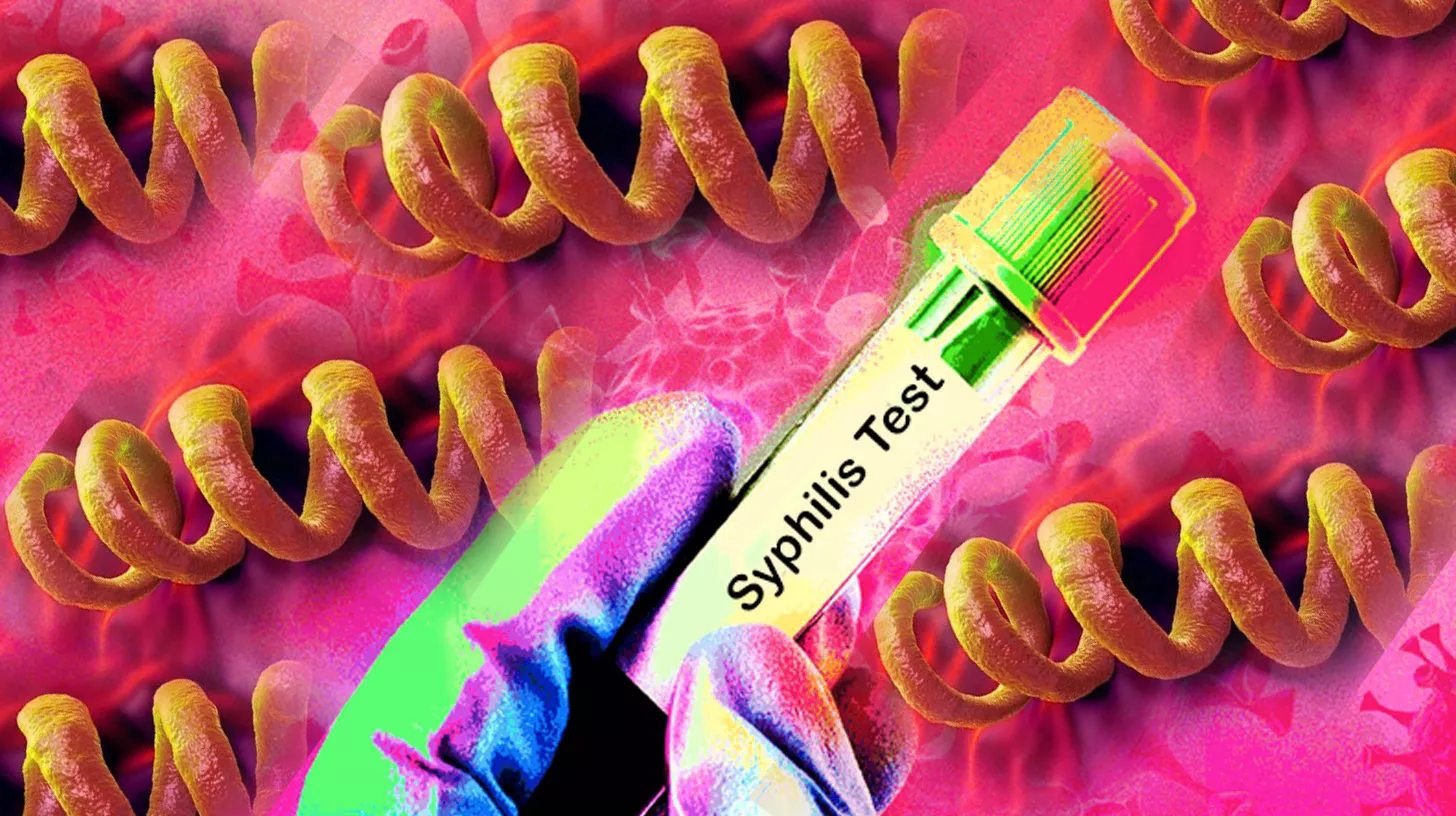 Syphilis in the Philippines: What You Need to Know and Where to Get Tested in Manila, Cebu, and Angeles-Clark